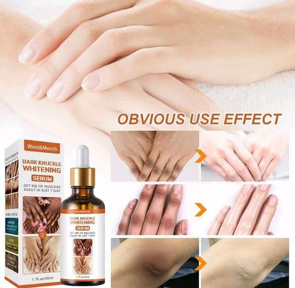 West and month knuckles oil
