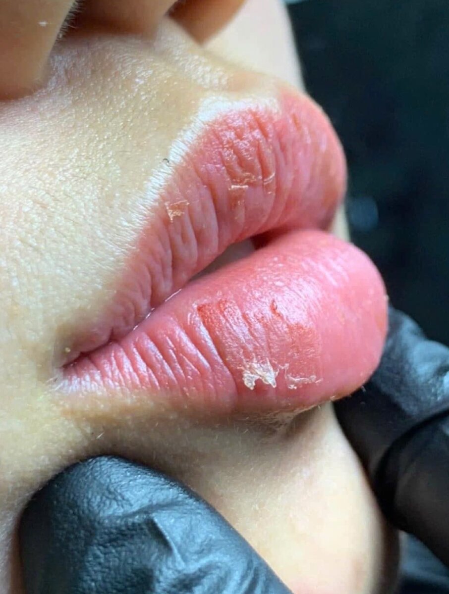 Baume à lèvre rose éclairci