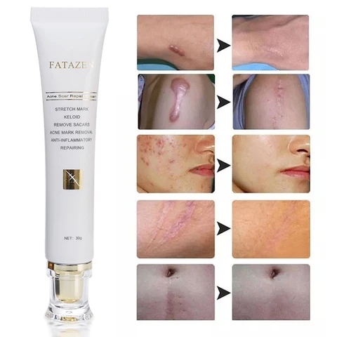 Crèmes Anti-cicatrice