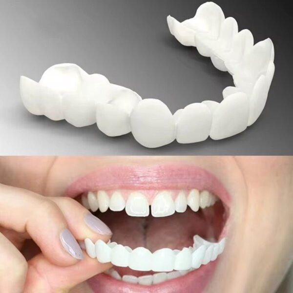 snap on custom veneers/ fake t
