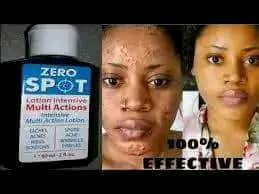 Zero spot