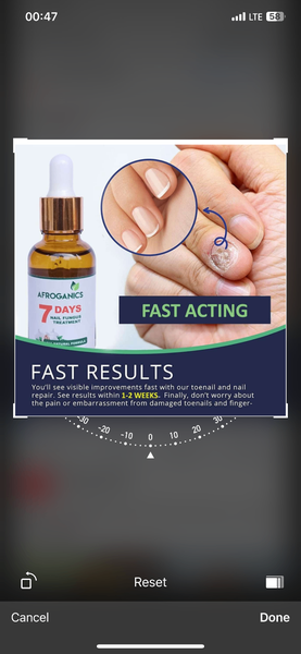 Nail treatment