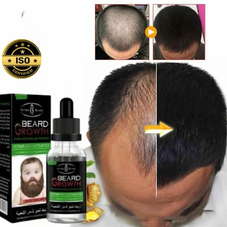 Anti calvitie 15j ultra