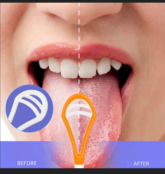 Tongue scraper