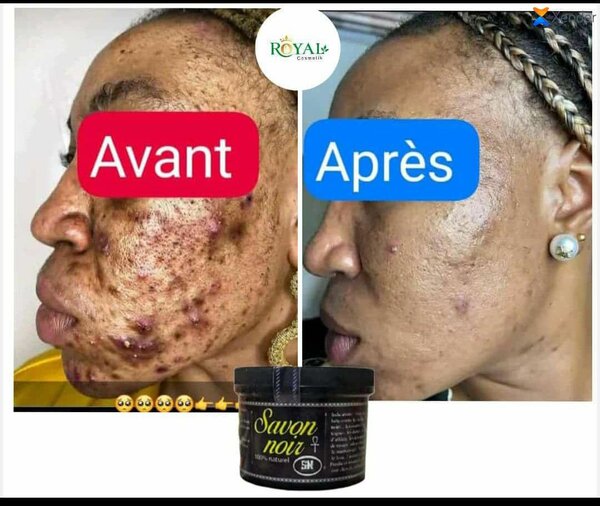 Savon noir