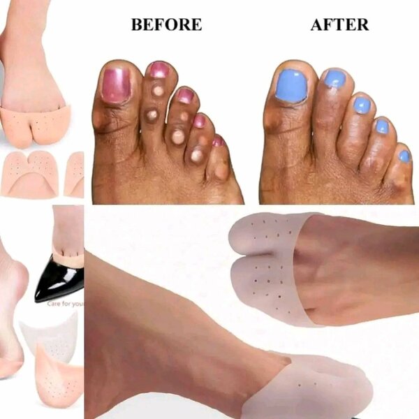 GEL TOE CAPS