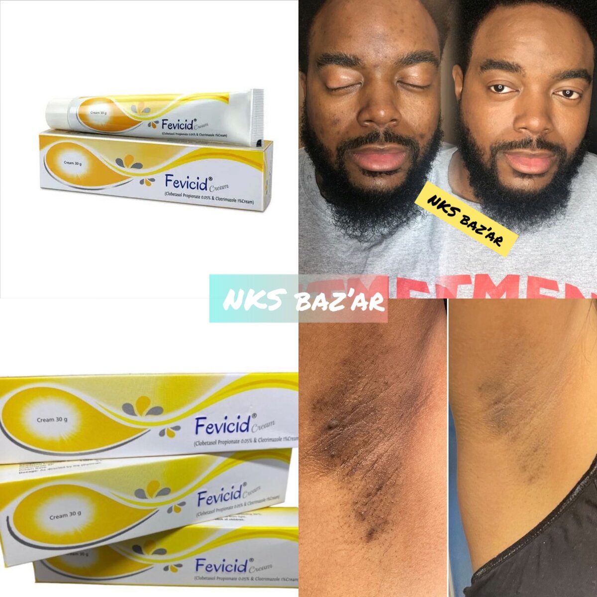 Fini les taches, acnés, pieds d´hathlètes et autres