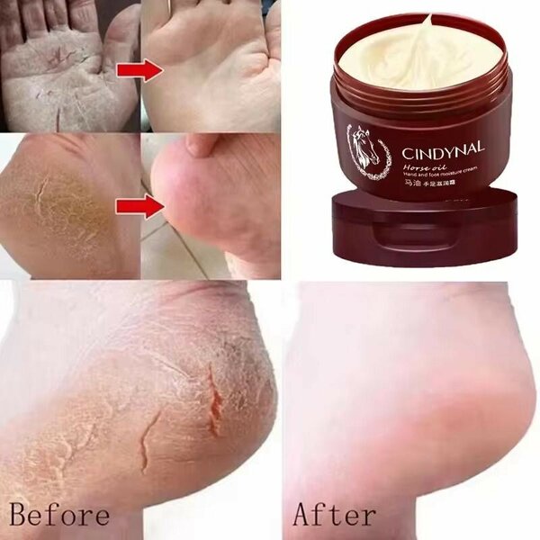 Crème Pieds Secs Réparatrice