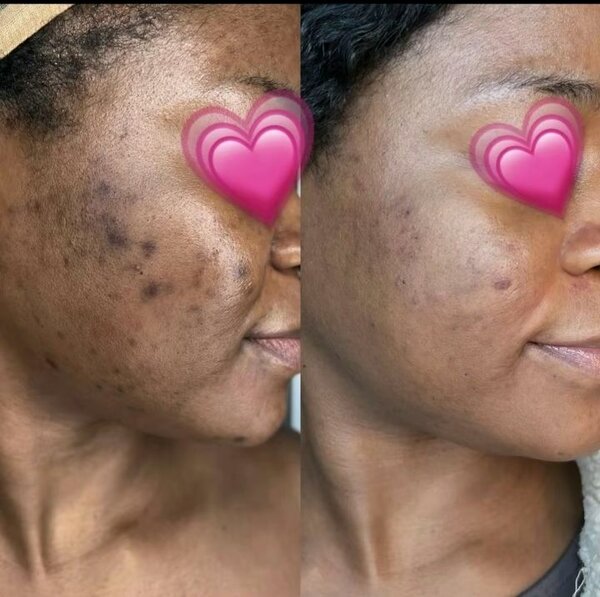 Savon naturel africain