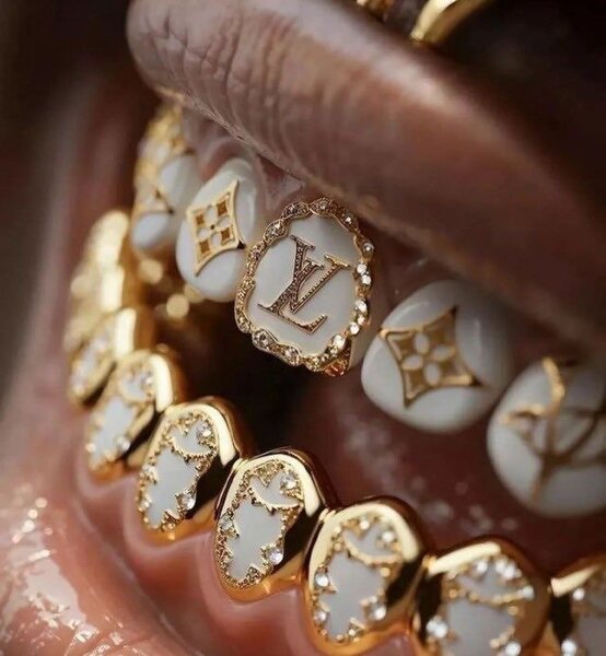 Silver teeth