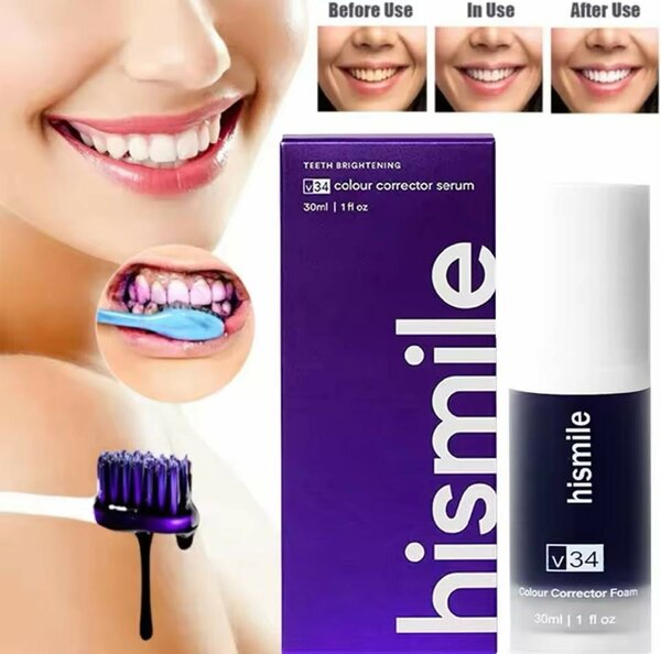 Teeth whitening