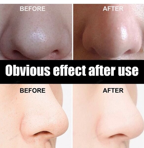 Nose strip