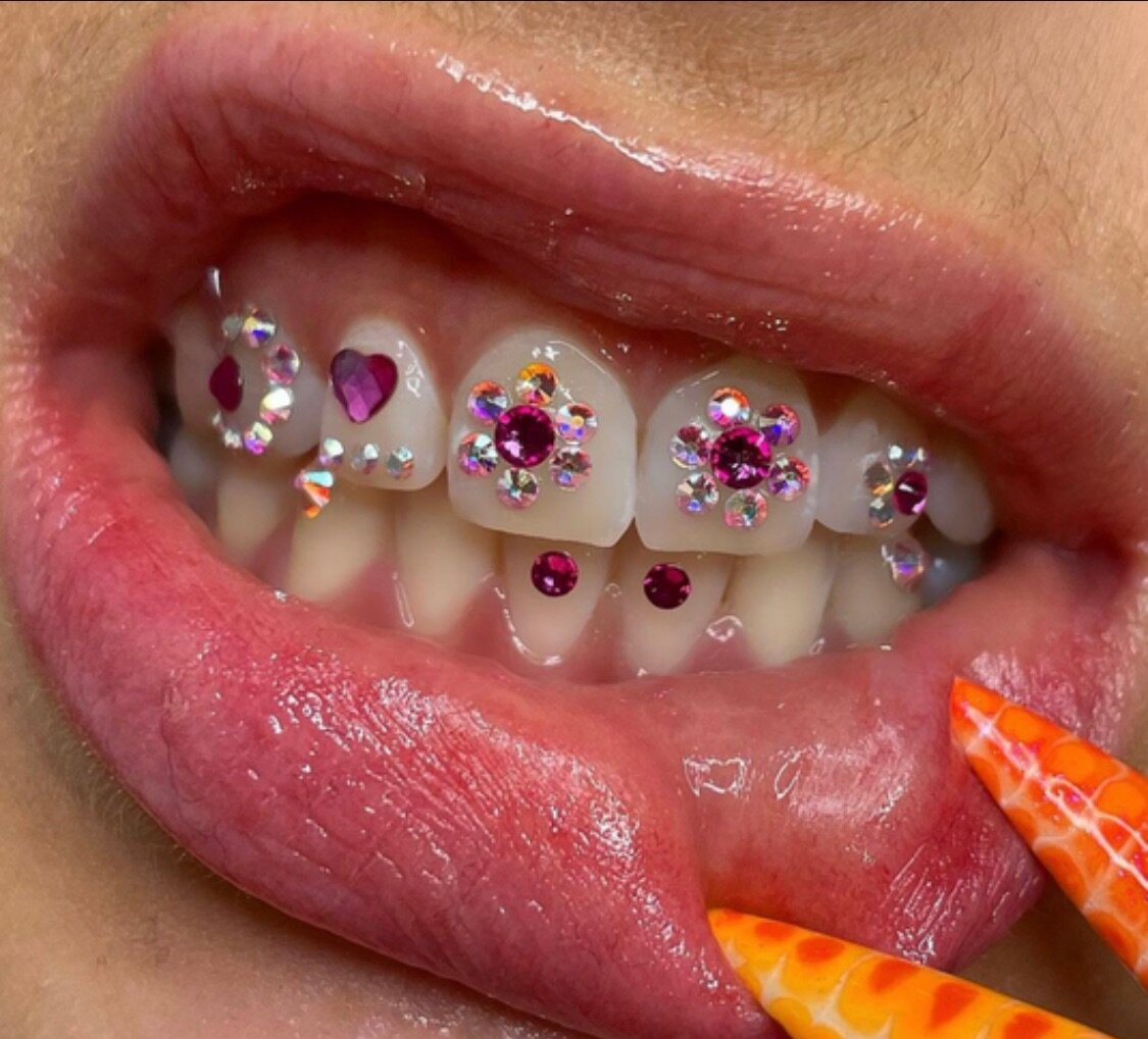Strass dentaire