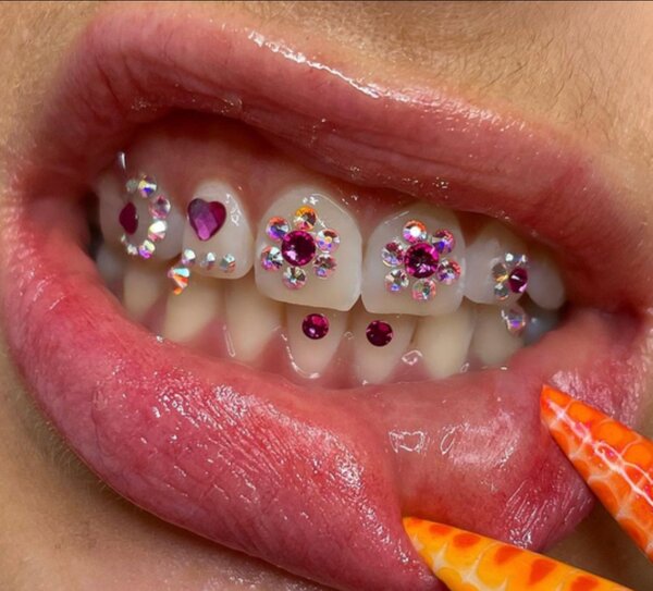 Strass dentaire