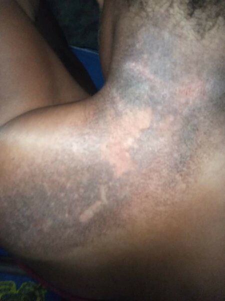 Soin Exfoliant  Peeling Mami