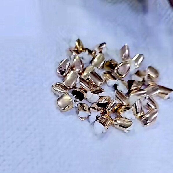 Original gold teeth