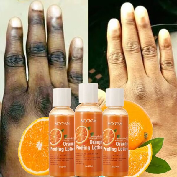 Lotion quintos