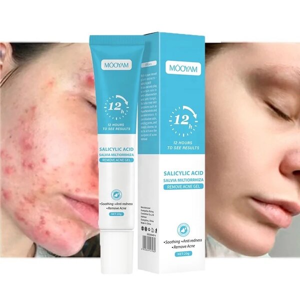 GEL ANTI-ACNE RAPIDE