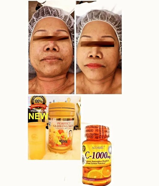 C-1000 mg