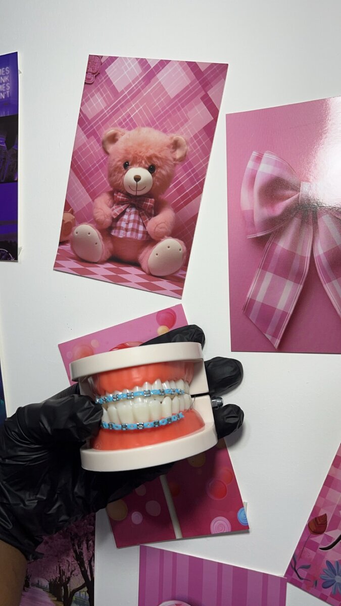 Fashion braces