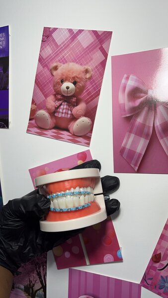 Fashion braces