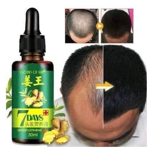 King of ginger hair oil