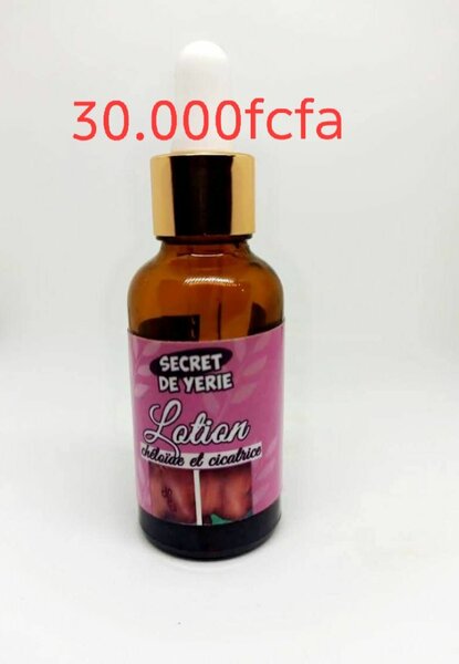 Lotion Keloid