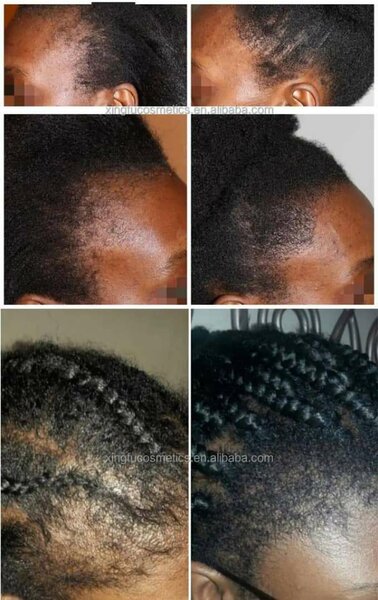 Sérum pour cheveux