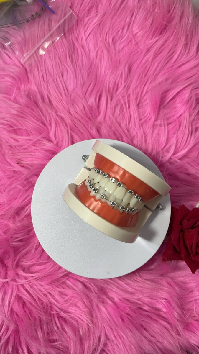 Fashion braces