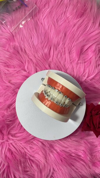 Fashion braces