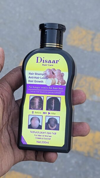 HAIR LOSS TREATMENT