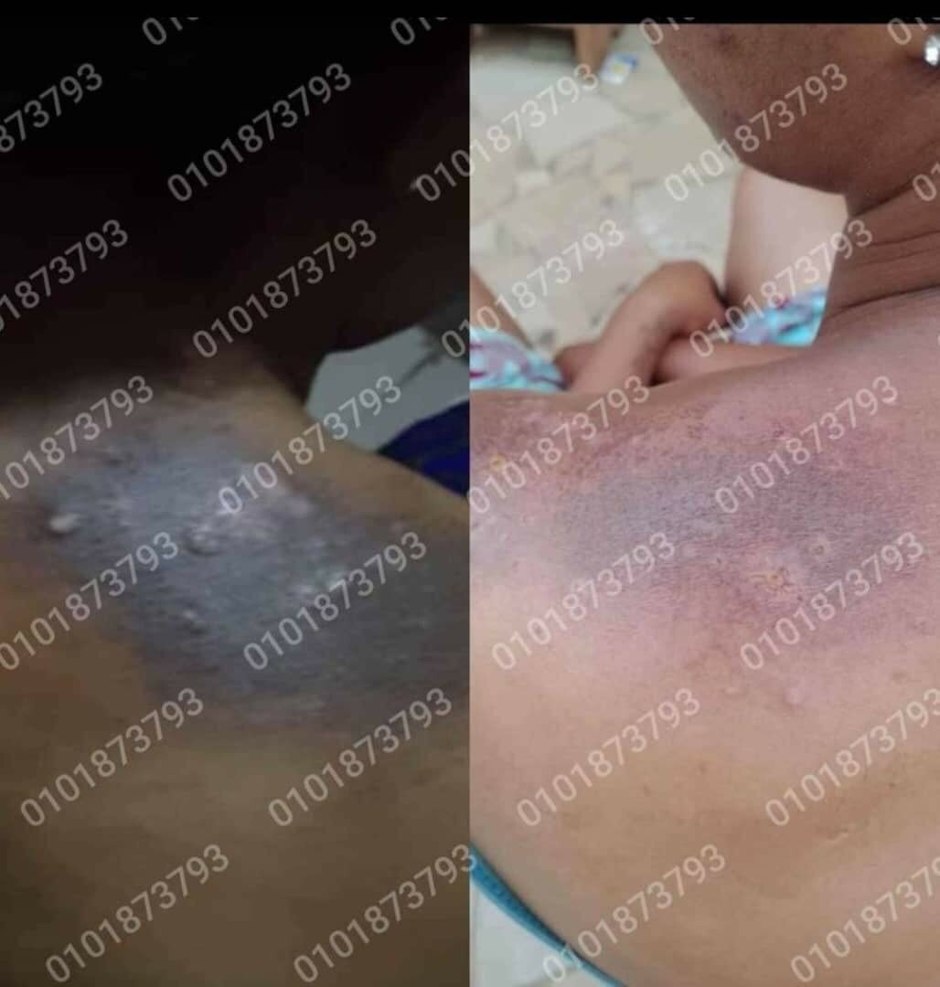 Huile peeling