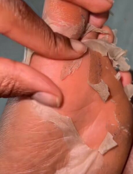 Footmask