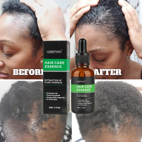 Essence Capillaire Anti-Chute