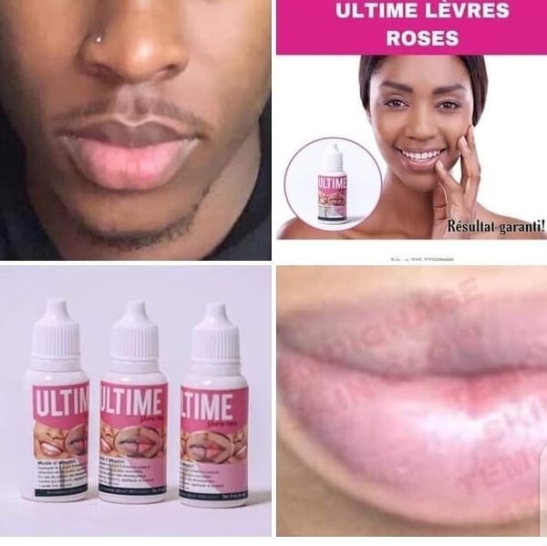 Ultime Lèvres Roses (Normal)