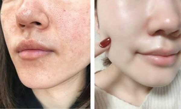 Savon de visage