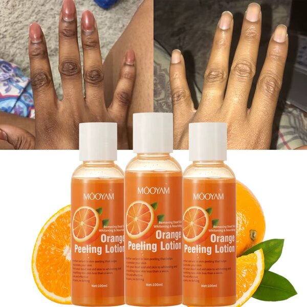 Lotion quintos