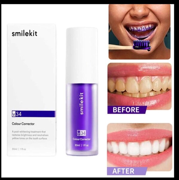 Smilekit