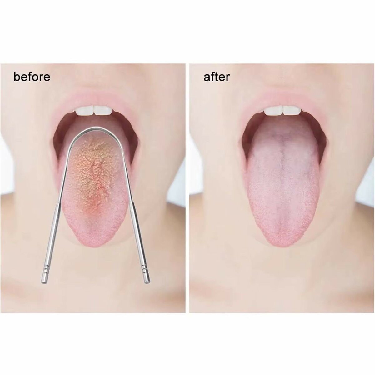 Gratte-langue en acier inoxydable