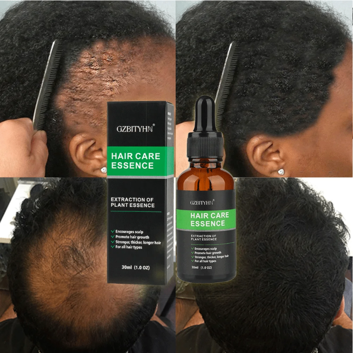 Essence Capillaire Anti-Chute