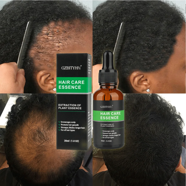 Essence Capillaire Anti-Chute