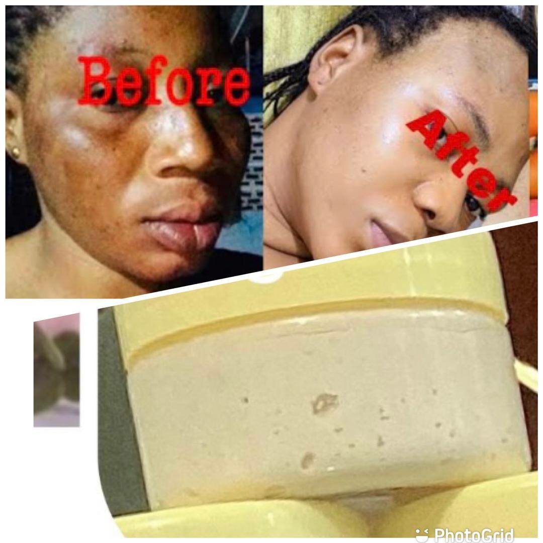 Face cream