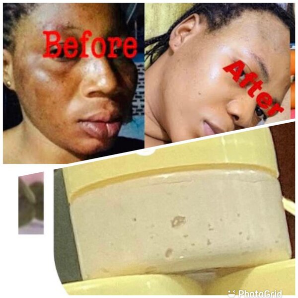 Face cream