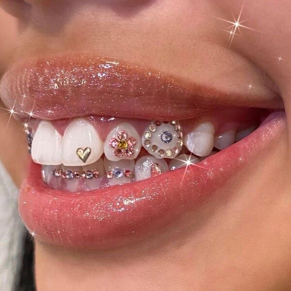 Strass dentaire