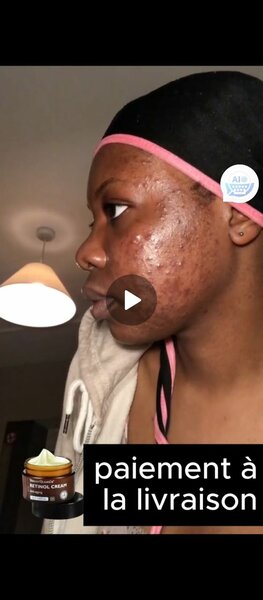Retinol cream