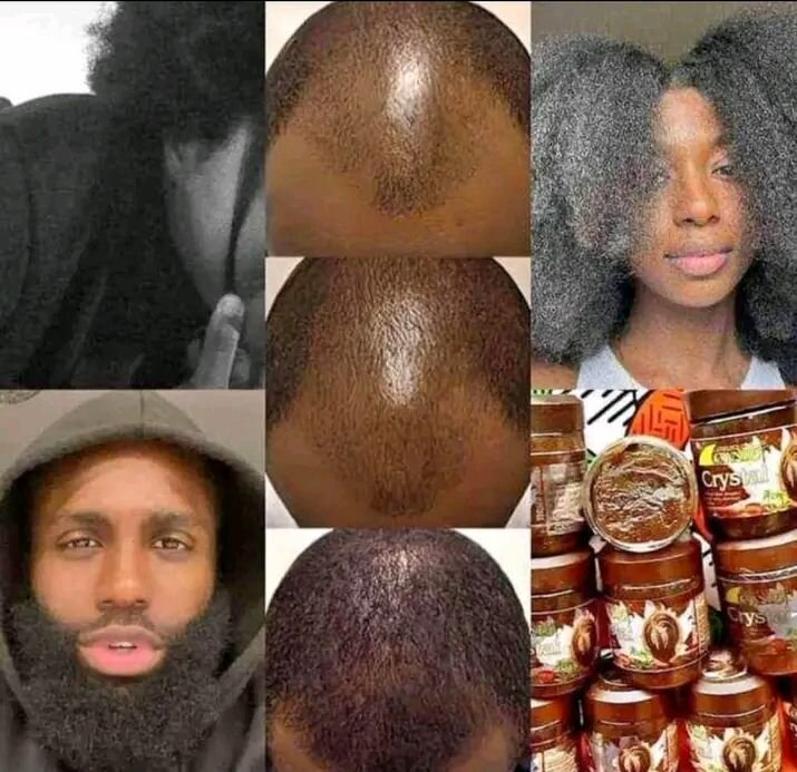 Pommade