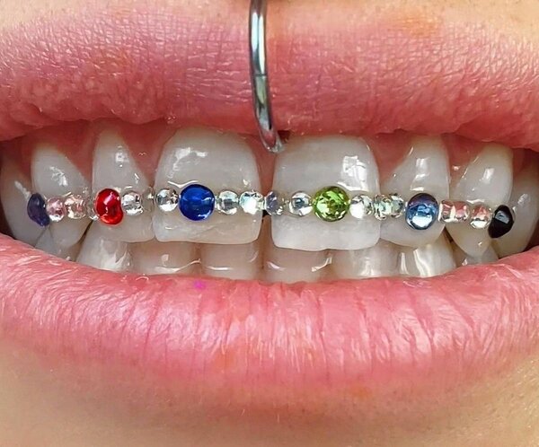 Strass dentaire