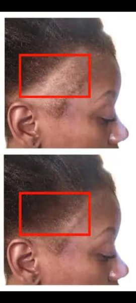 Miracle Hair 3 en 1