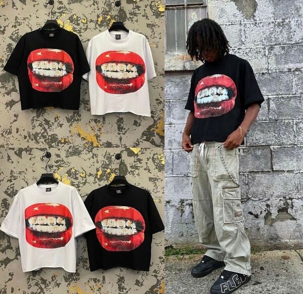 Oversize