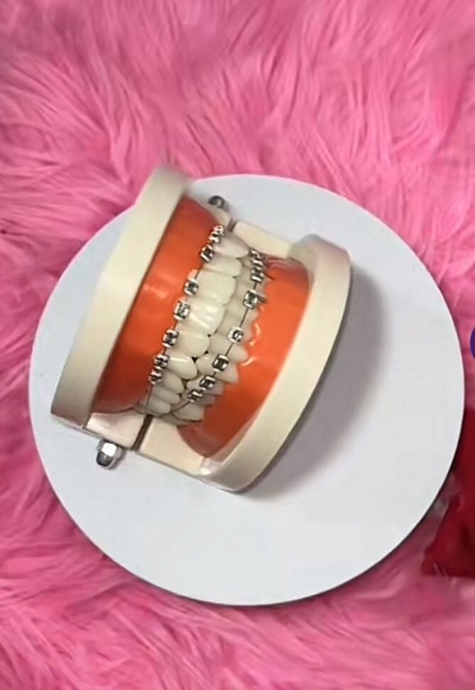 Fashion braces